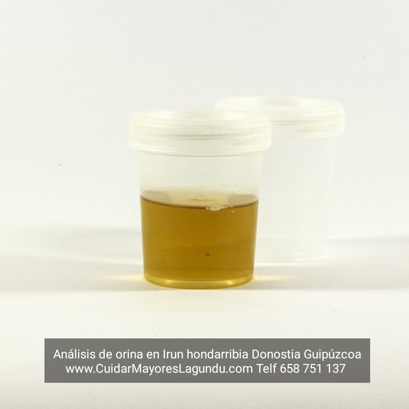 Analisis de orina en irun hondarribia donostia guipuzcoa